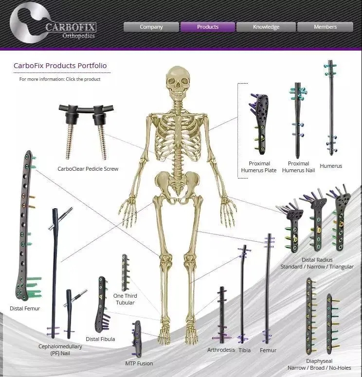 骨科材料在人体骨骼中的应用图示