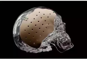 医用3D打印的新工艺与新材料是骨科植入制造的技术支撑